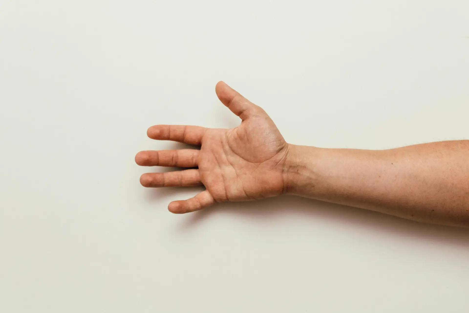 Understanding Brachioradial Pruritus: How Cervical Spine Nerve Irritation Triggers Symptoms and How Upper Cervical Chiropractic at Lavender Family Chiropractic Provides Lasting Relief