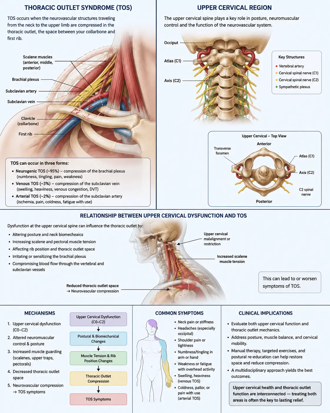 Thoracic Outlet Syndrome in Sarasota, Florida: How Upper Cervical Chiropractic Care at Lavender Family Chiropractic Addresses the Postural and Nerve Compression Behind the Symptoms for Proven Results