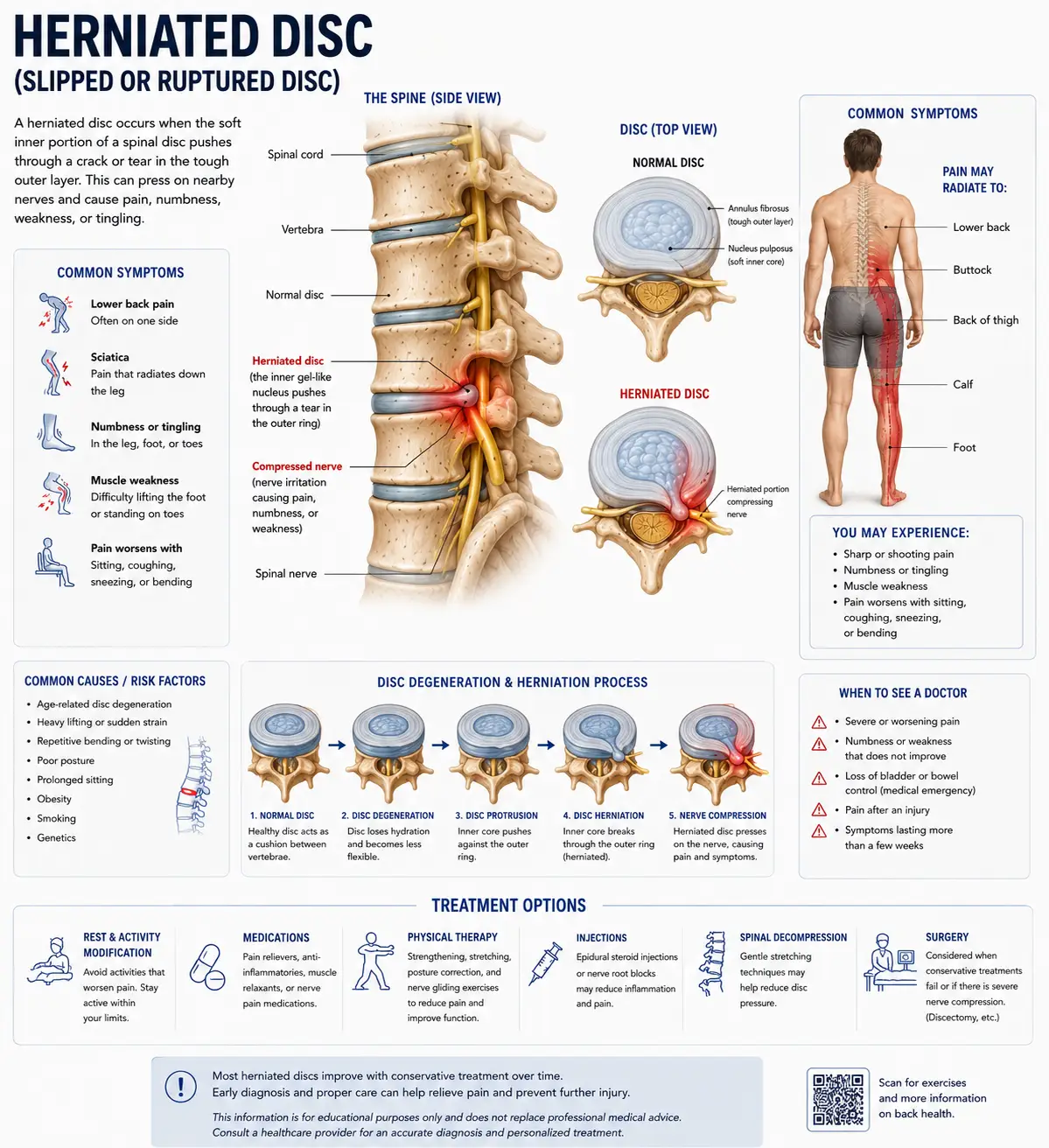 Cervical Herniated Disc in Sarasota, Florida: Understanding Neck Disc Herniation and Natural Neck Pain Relief at Lavender Family Chiropractic