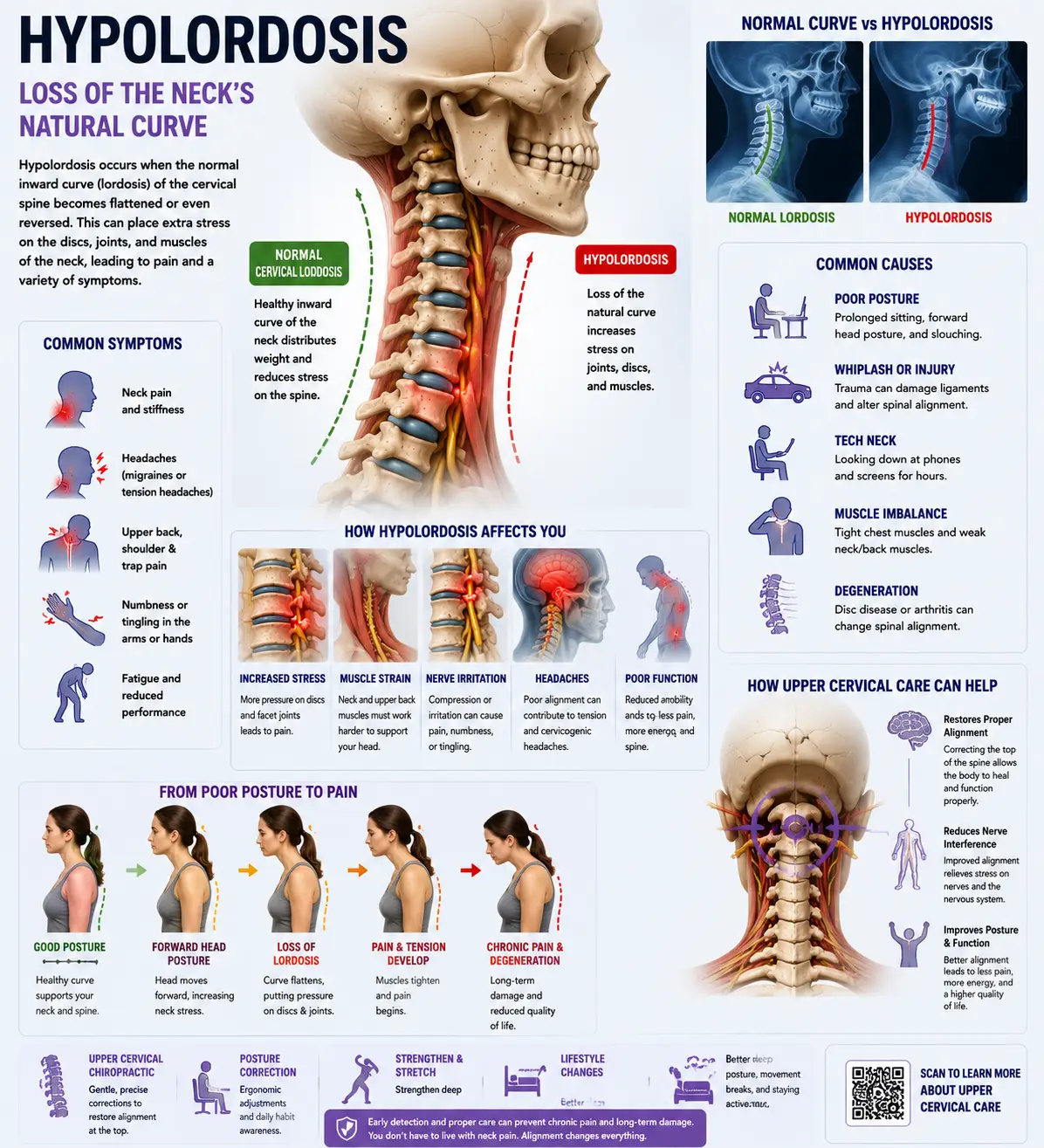 Loss of Cervical Curve and Military Neck in Sarasota, Florida: Understanding a Straightened Neck and Natural Neck Pain Relief at Lavender Family Chiropractic