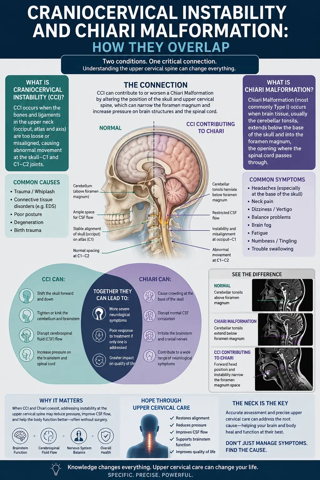 chiari malformation and craniocervical instability in sarasota