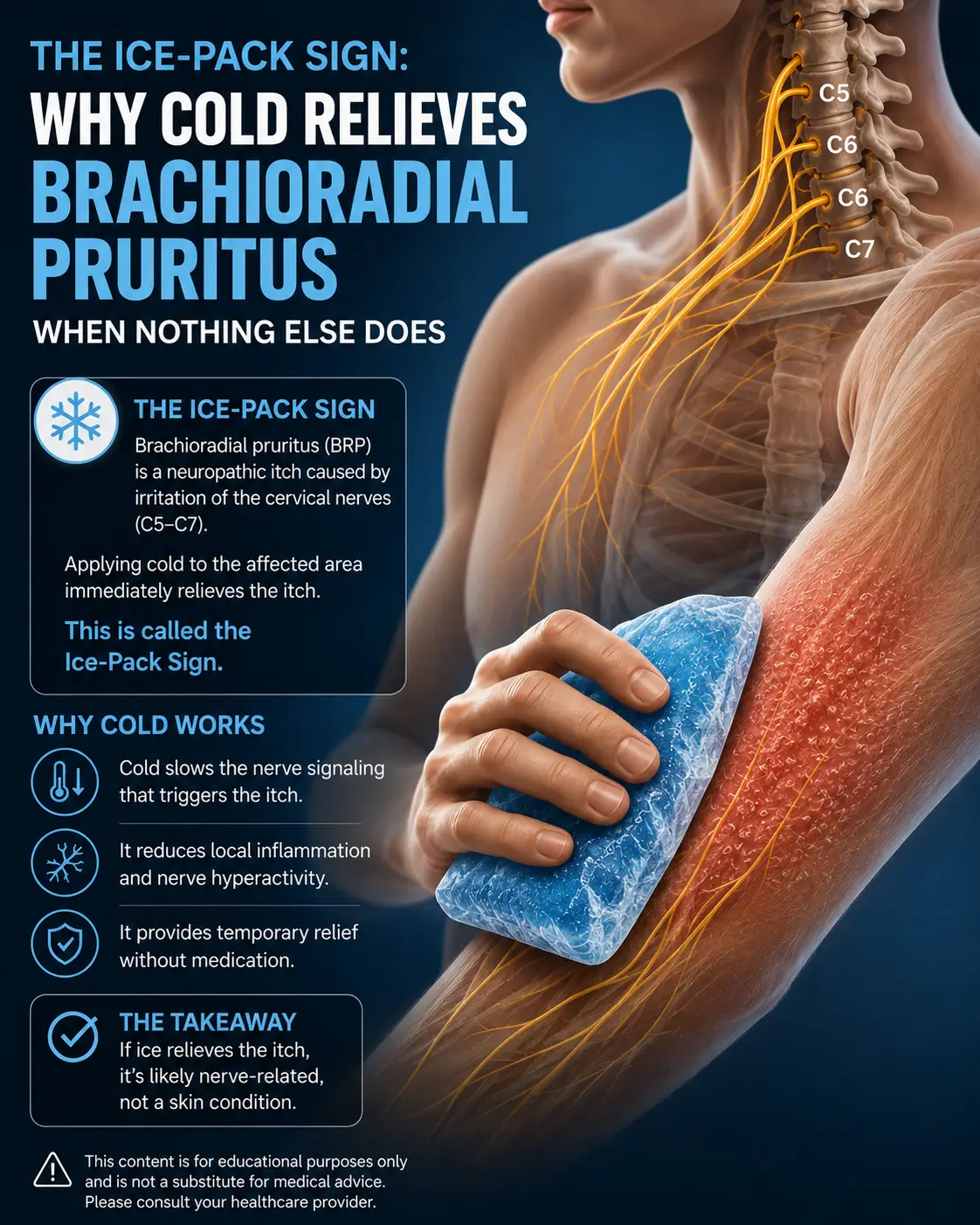 ice-pack sign and brachioradial pruritus in sarasota and Lakewood Ranch