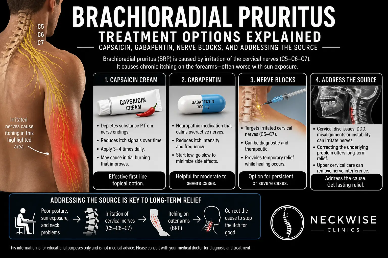 Treatment Options for Brachioradial Pruritus in Sarasota Florida
