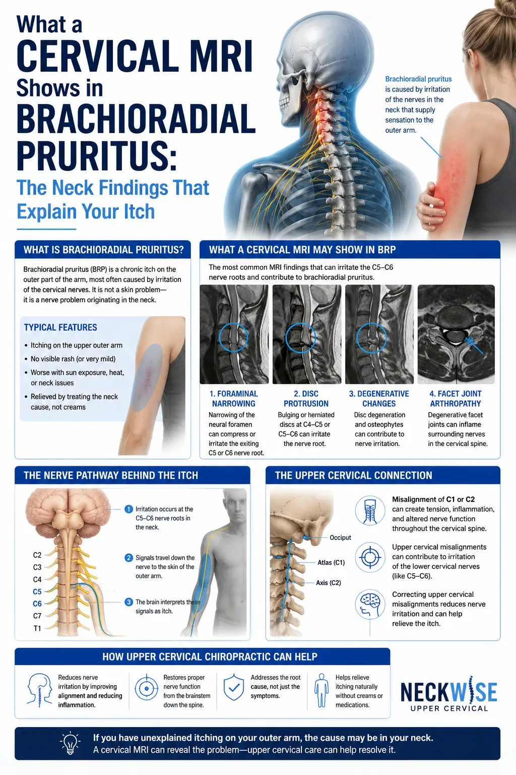 What a Cervical MRI Shows in Brachioradial Pruritus: The Neck Findings That Explain Your Itch